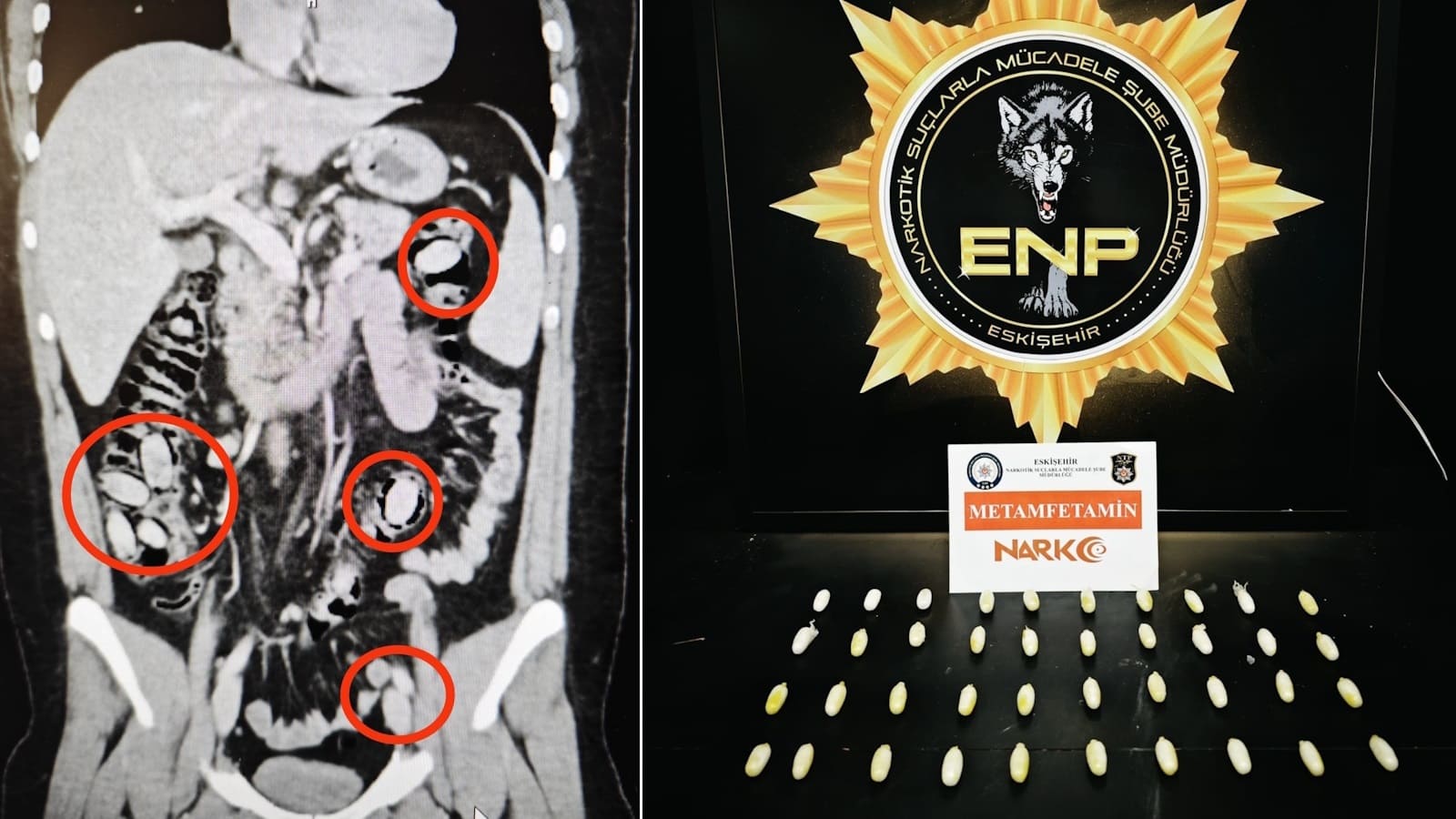 Eskişehir uyuşturucu operasyonu raporu: Son 1 ayda 316 kişi yakalandı